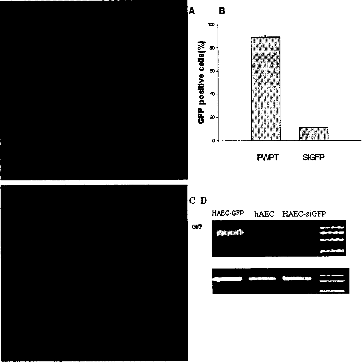 Human amnion cell capable of expressing extraneous gene and its preparation method and uses