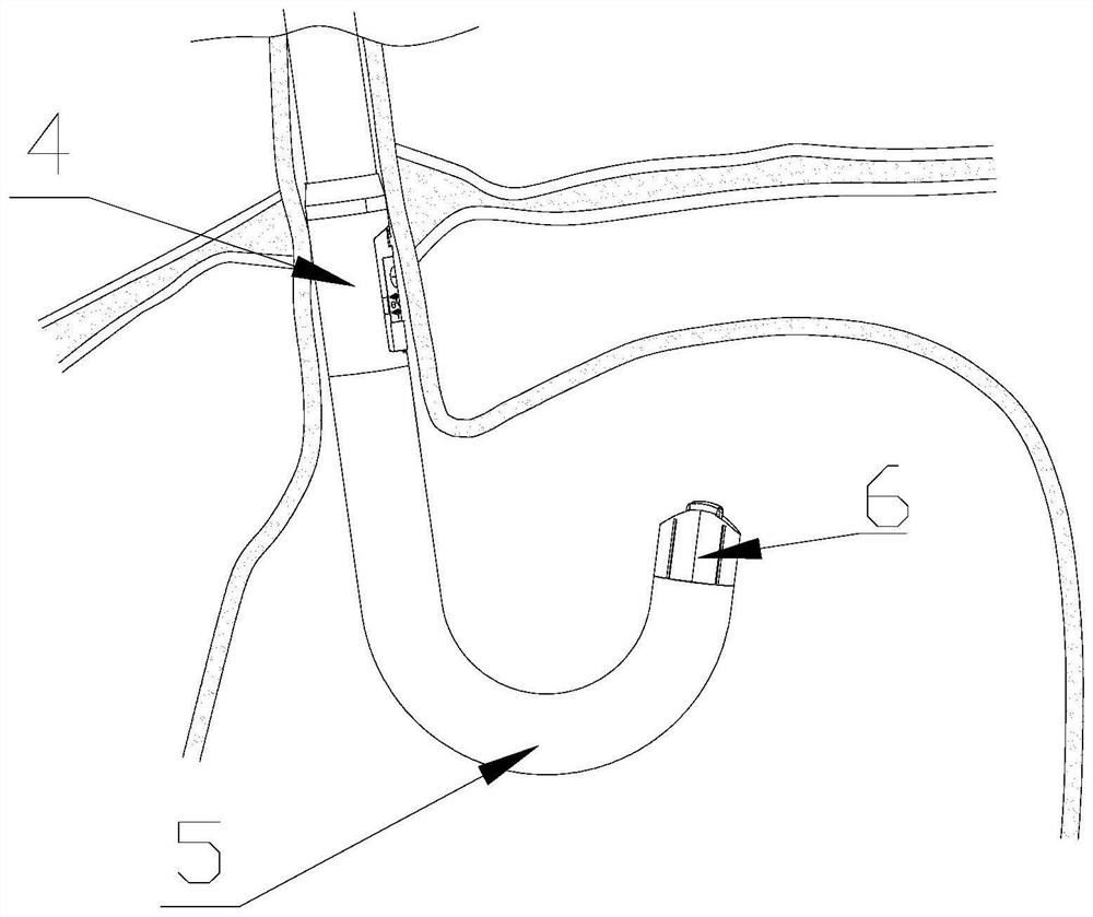 Rigid section of endoscopic nailing device for implementing fundus gastrostomy