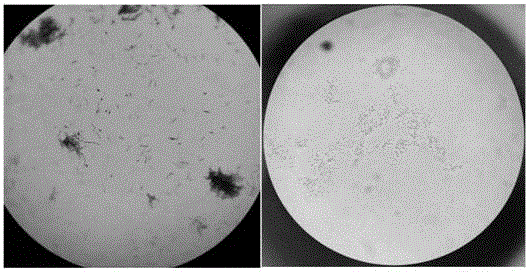 Method for producing water-soluble fertilizer containing glycotropic bacillus and amino acid