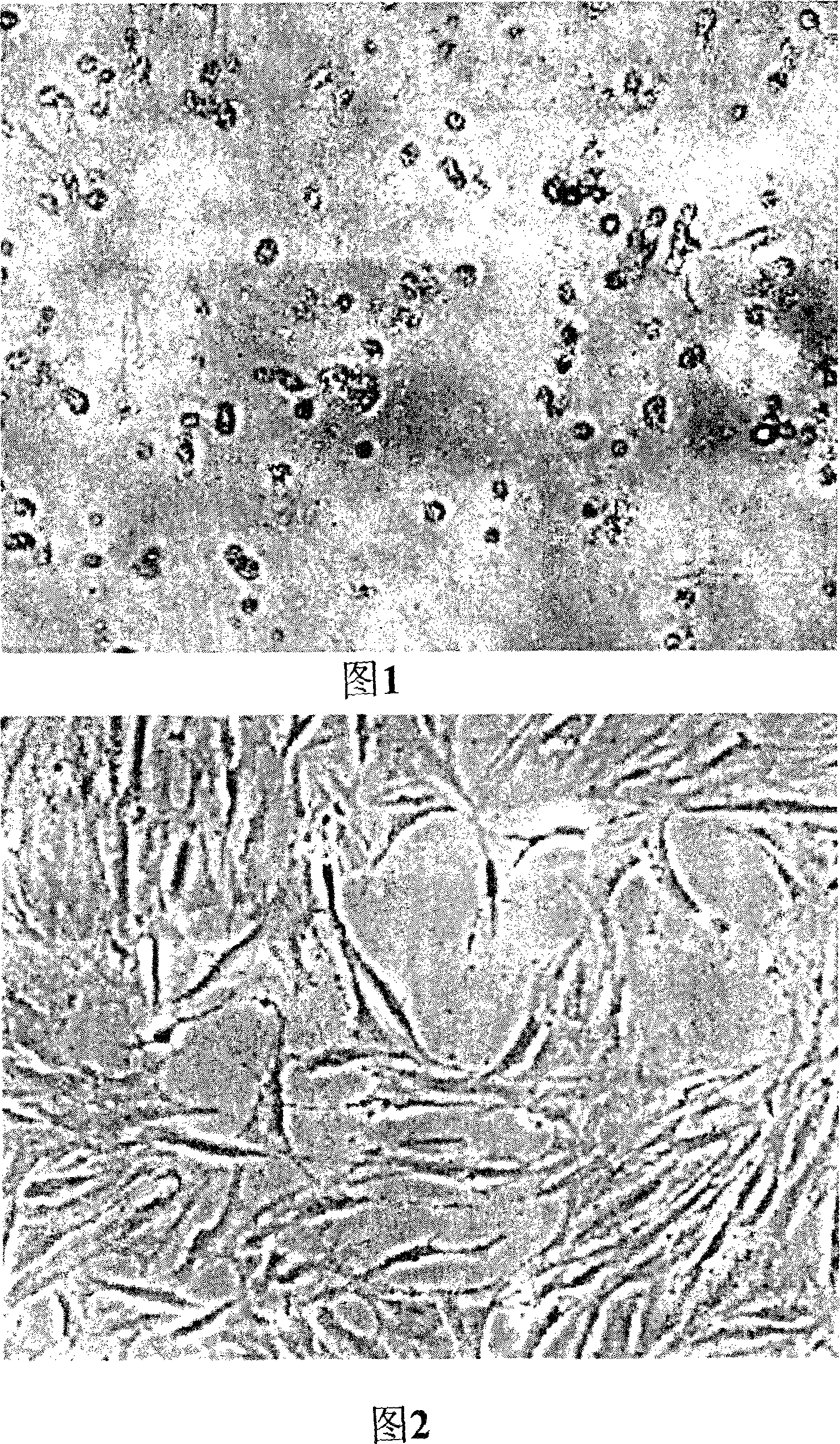 Antitumor composition