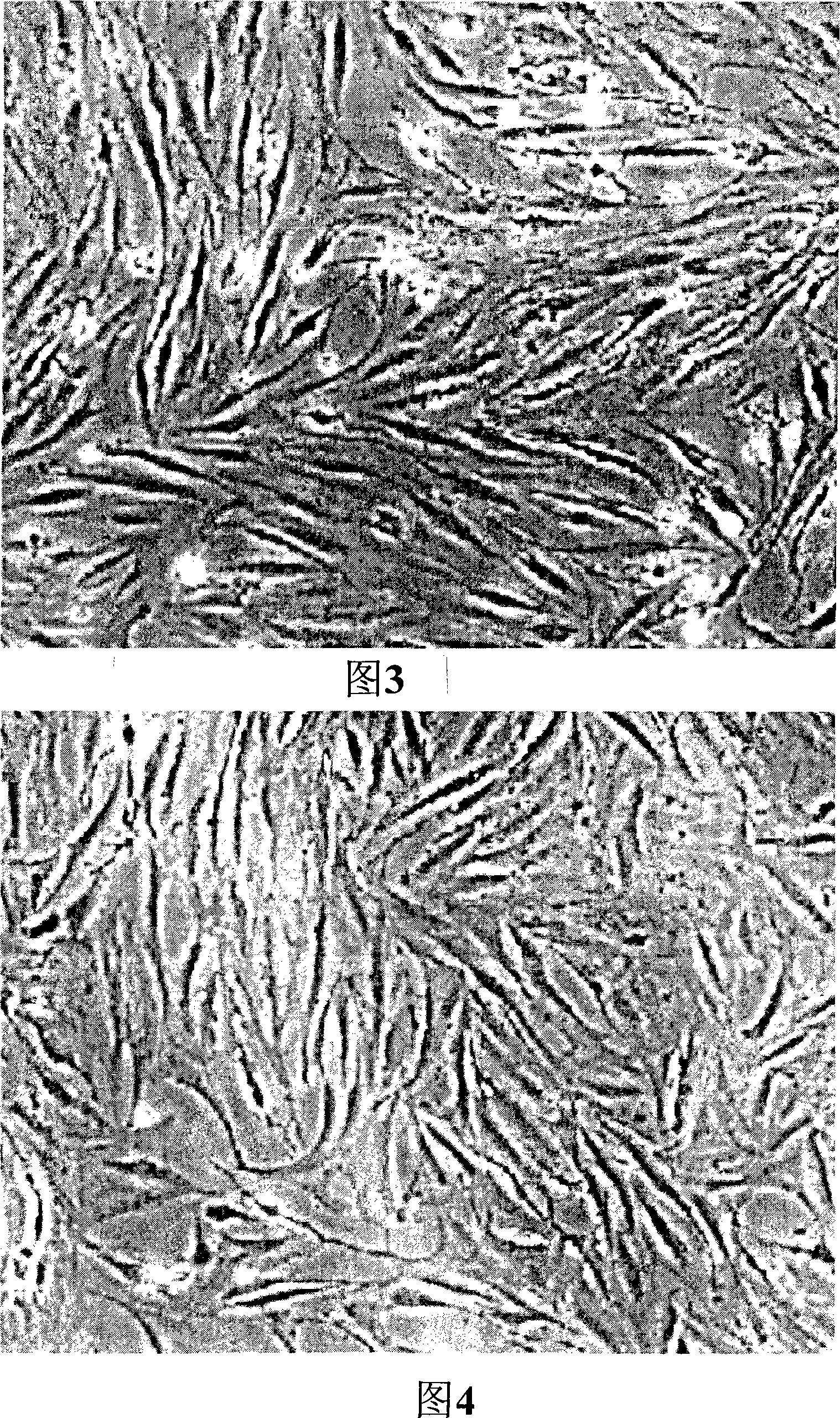 Antitumor composition