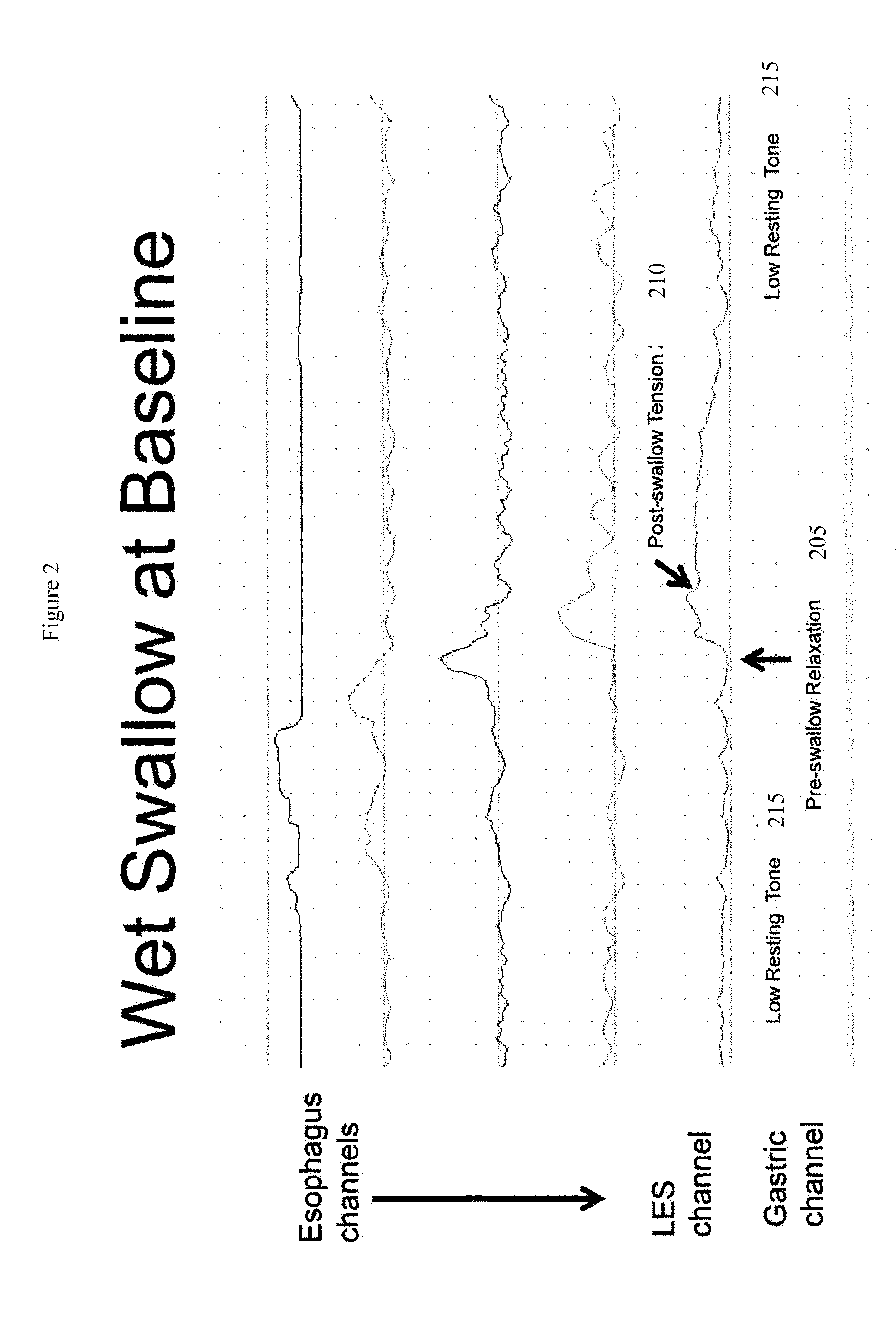 Device and implantation system for electrical stimulation of biological systems