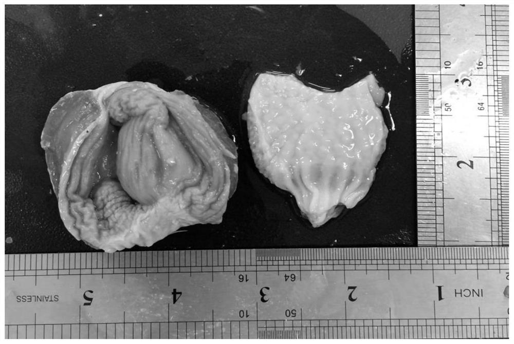 Feed additive for preventing inflammation of muscular gaster and proventriculitis of broiler chickens