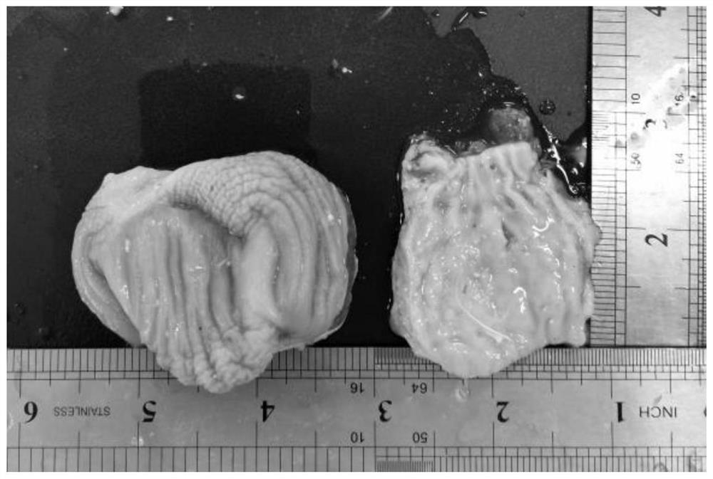 Feed additive for preventing inflammation of muscular gaster and proventriculitis of broiler chickens