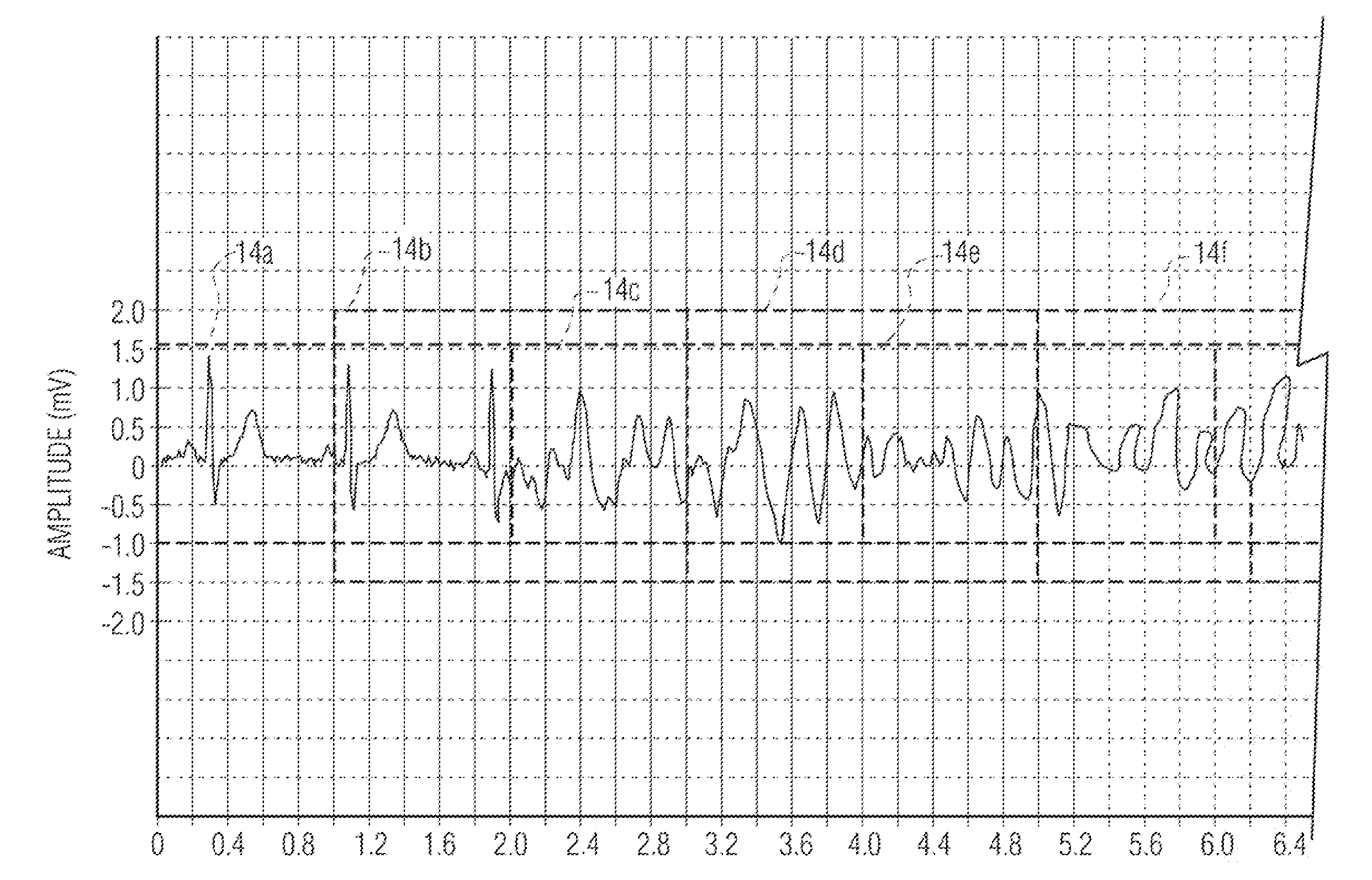 Circuit and method for analyzing a patient's heart function using overlapping analysis windows