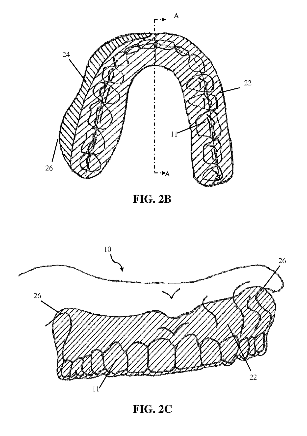 Intra-oral appliance and methods of using same