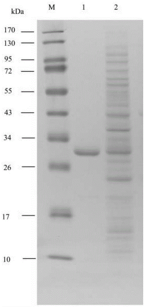 Varroa destructor toxic protein and coding gene thereof, and application thereof