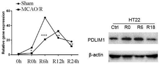 Application of PDLIM 1 in protection of cerebral ischemic neuron injury