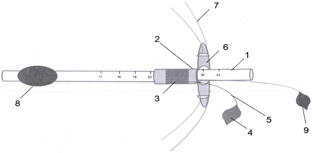 Bite block shaped pipeline fixator