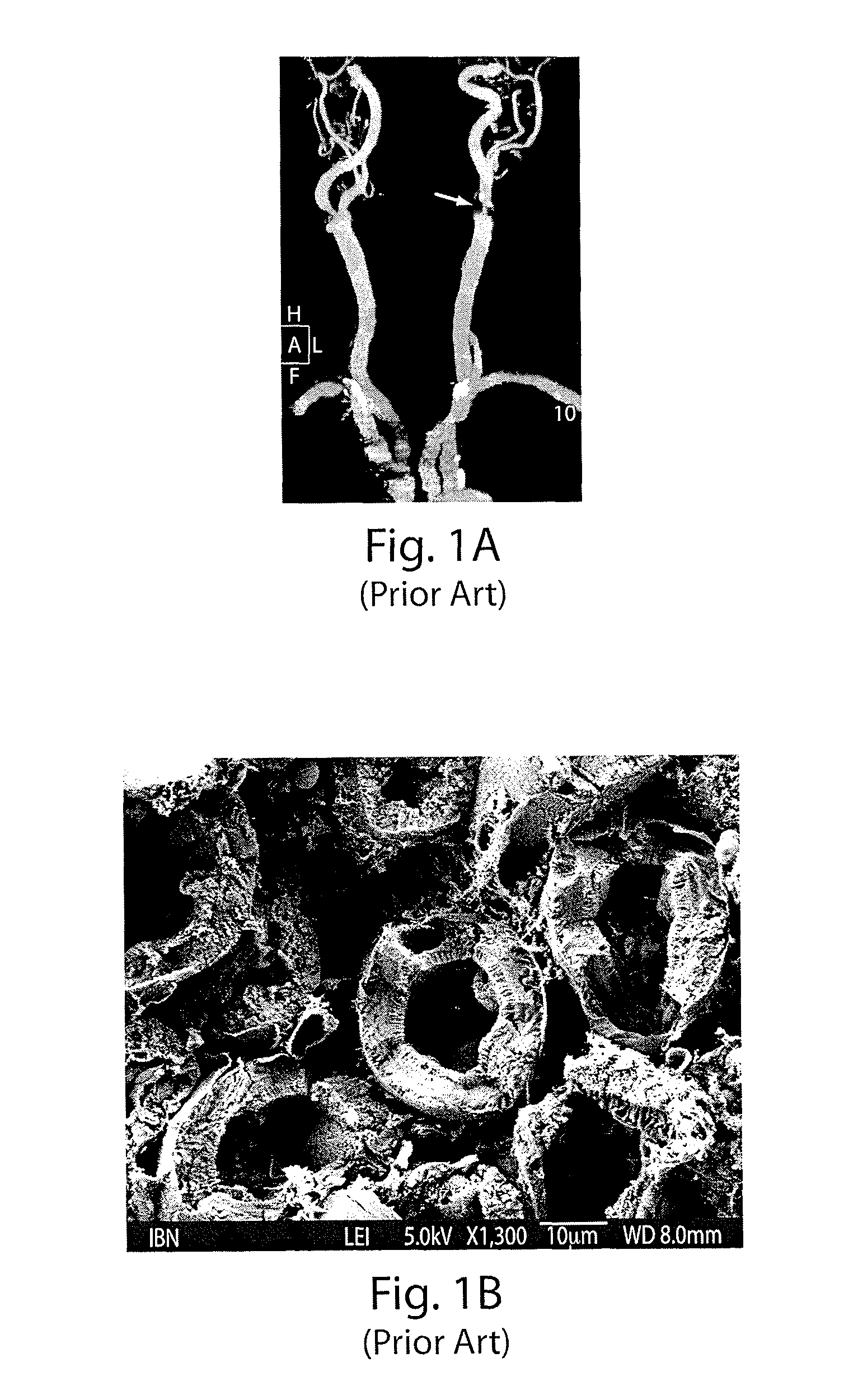 Three-dimensional fabrication of biocompatible structures in anatomical shapes and dimensions for tissue engineering and organ replacement