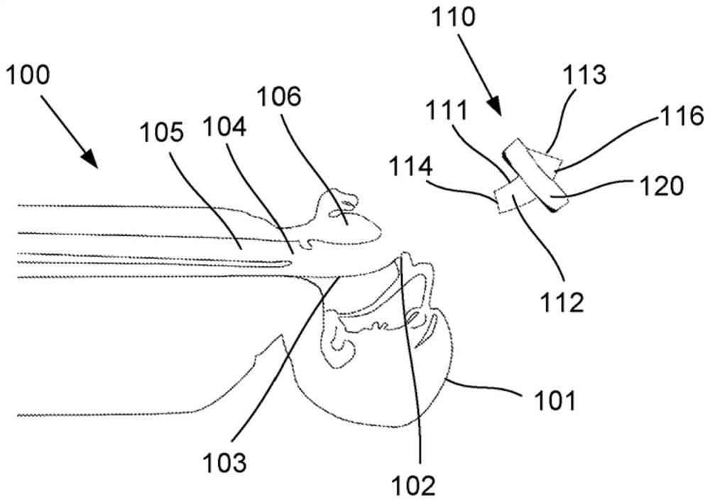 Shielded cannula guide and method