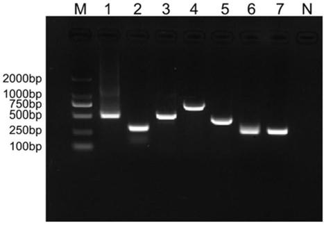 Visual chip for synchronously detecting six avian viruses