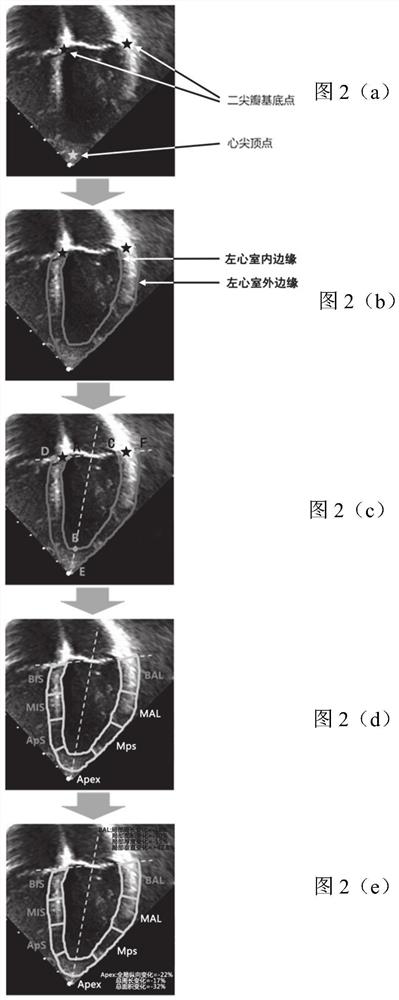 Cardiac medical image processing device, processing system and medium