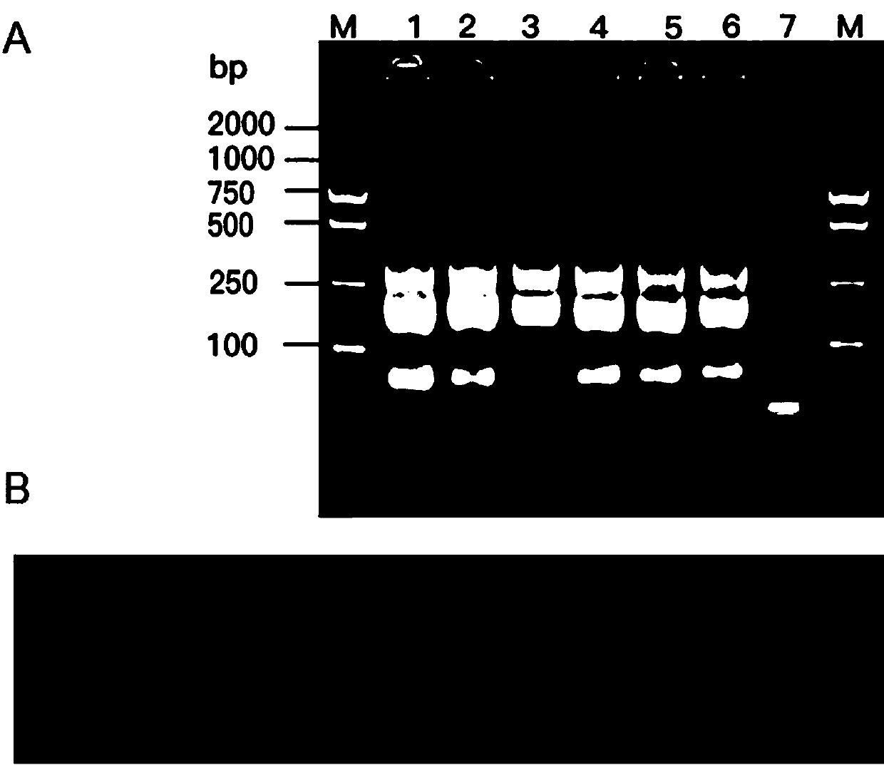 LAMP (loop-mediated isothermal amplification) detection primer of fusarium proliferatum and application of LAMP detection primer