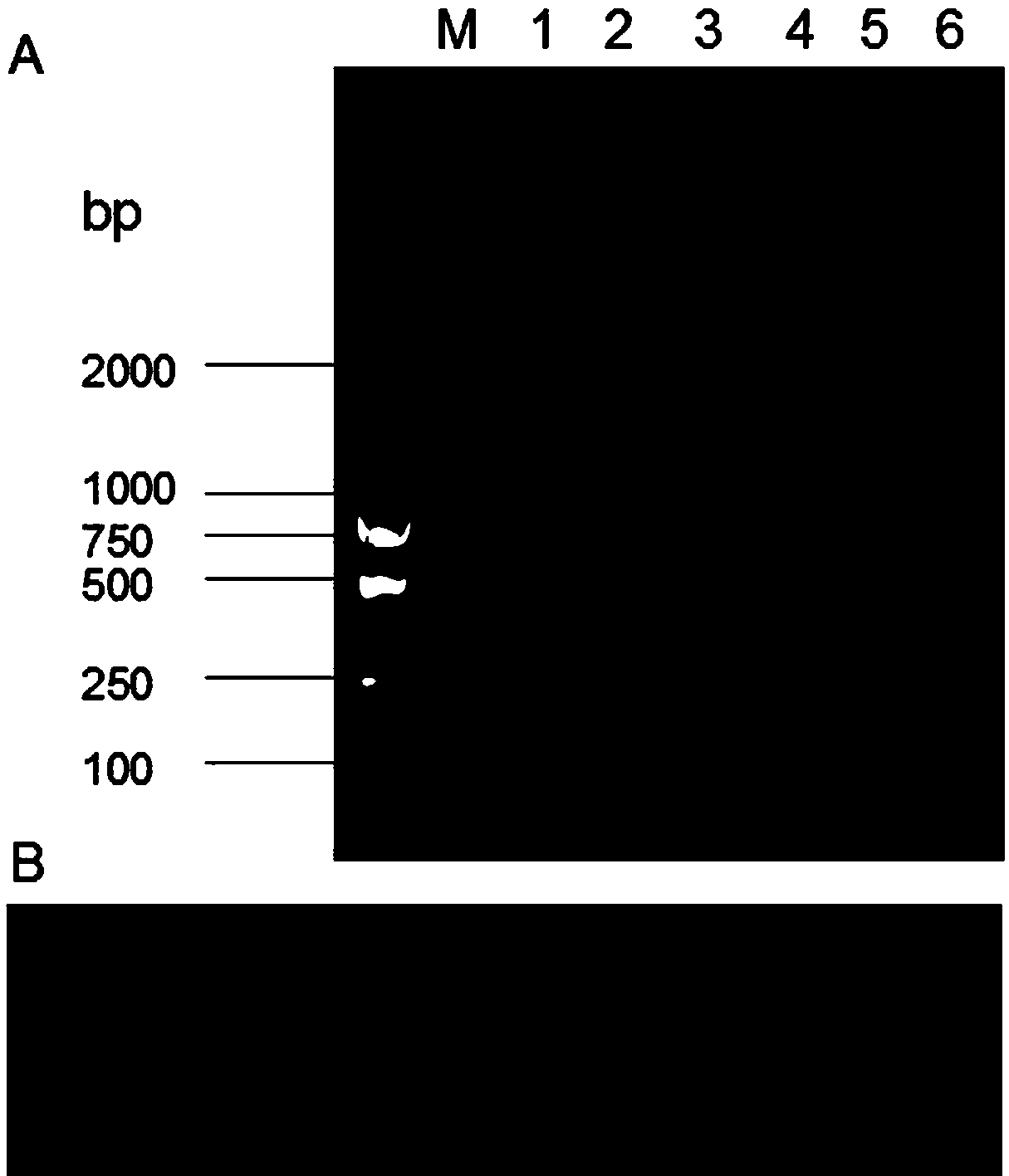 LAMP (loop-mediated isothermal amplification) detection primer of fusarium proliferatum and application of LAMP detection primer