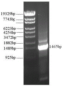 Genetically engineered bacterium for producing L-aspartic acid through fermentation