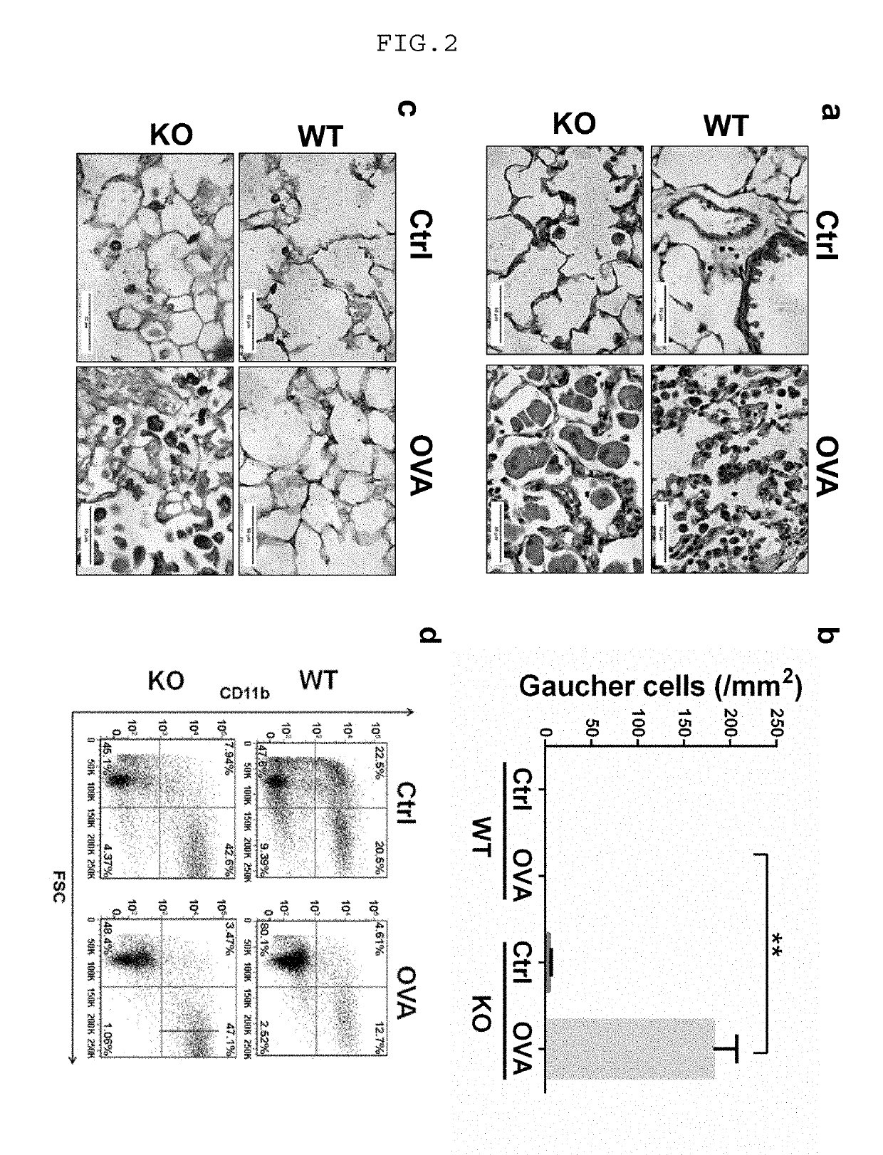 Progranulin (PGRN) and its derivatives for diagnosis and treatment of lysosomal storage diseases