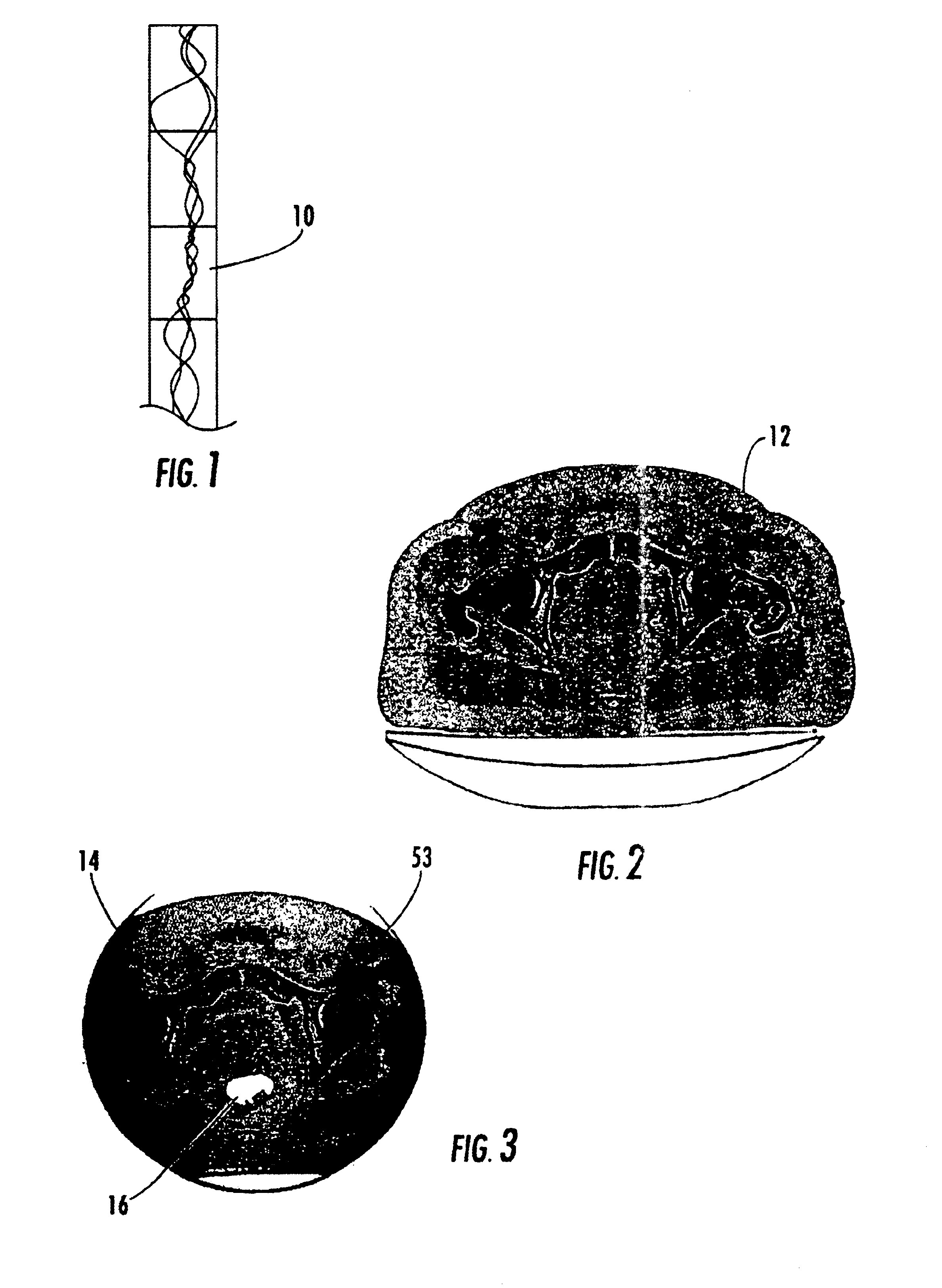 Method for reconstruction of limited data images using fusion-aligned reprojection and normal-error-aligned reprojection