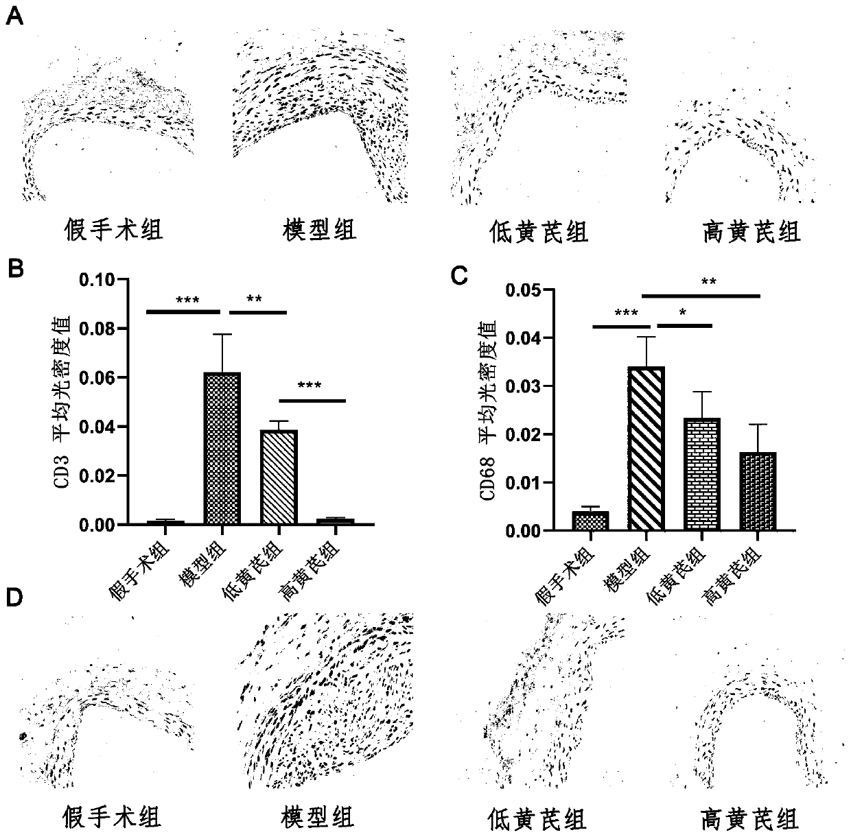 Application of astragaloside IV in inhibiting local inflammatory response and treating arterial restenosis