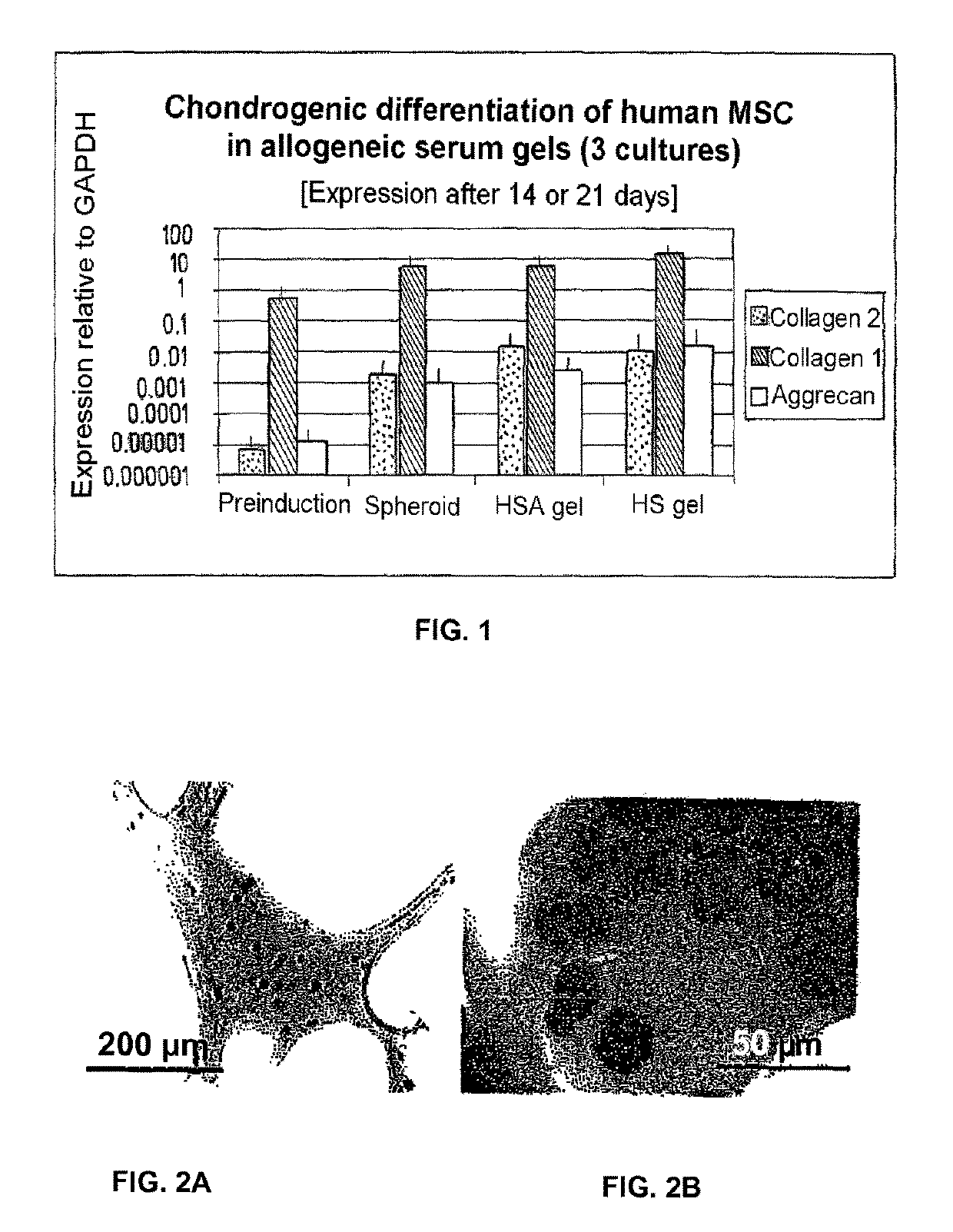 Injectable biocompatible composition