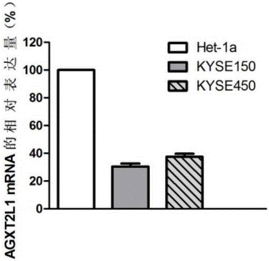 Molecular target of esophageal squamous carcinoma