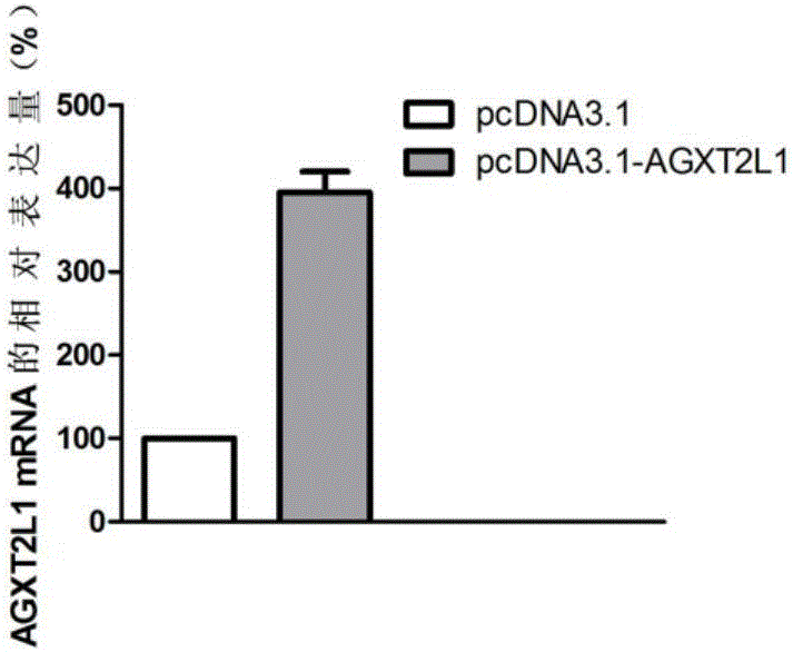 Molecular target of esophageal squamous carcinoma