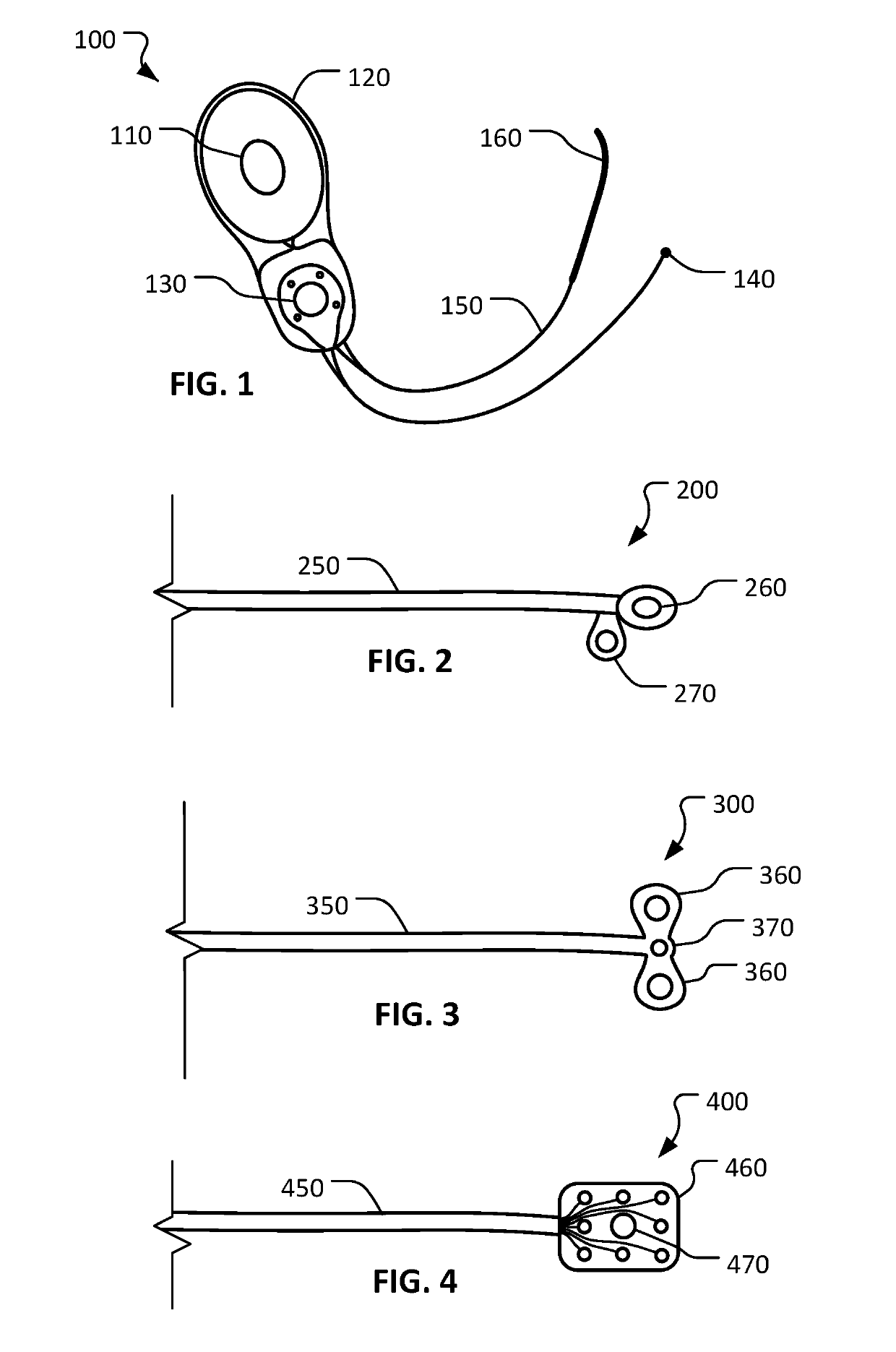 Devices and methods for treating tinnitus using electrical stimulation