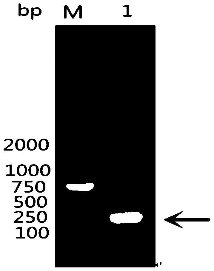 Kit and application based on recombinant protein of Riemerella anatipestifer omph truncated