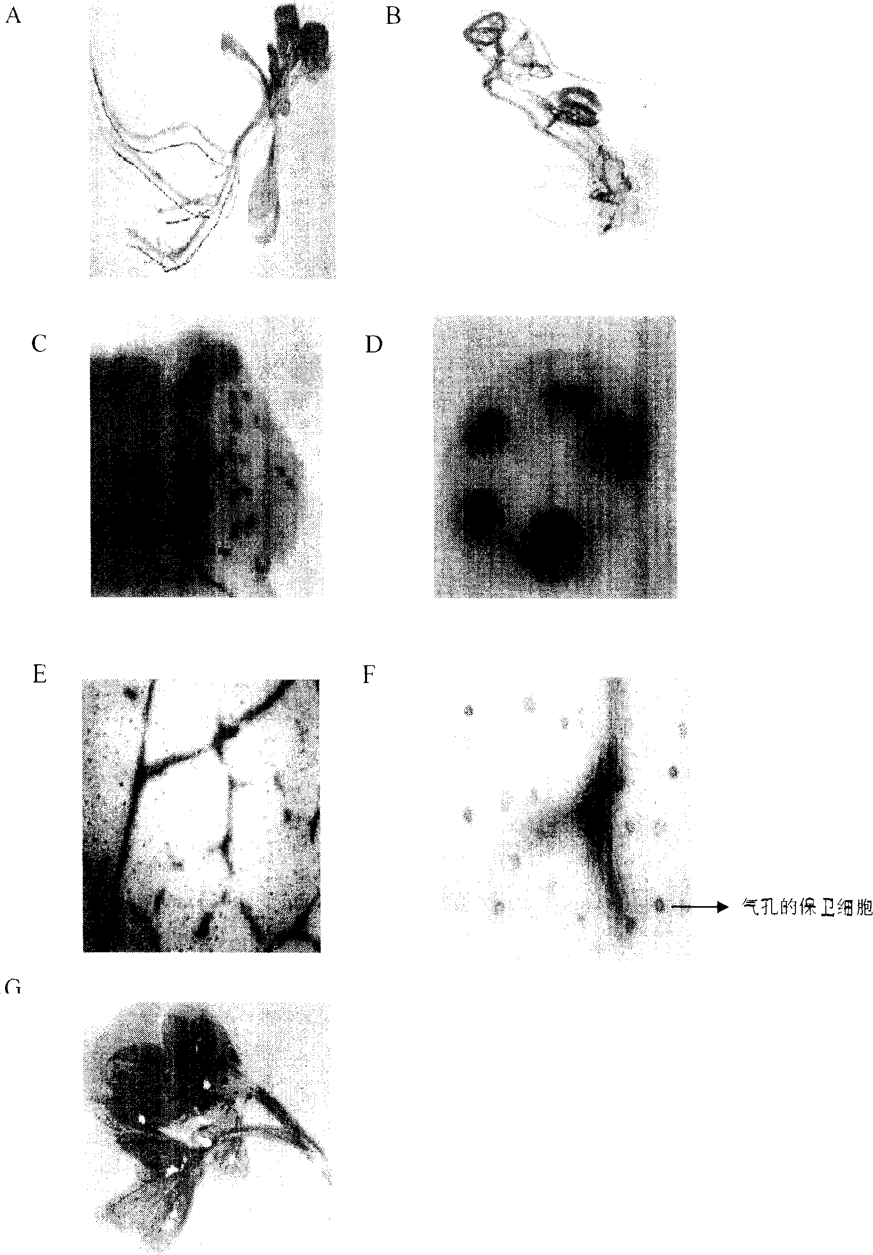 Cotton tissue specific and pathogenic bacterium inducing promoter and its use