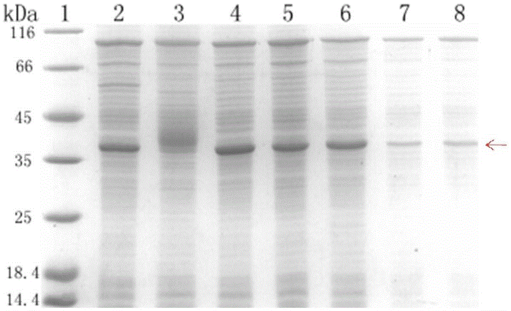 Method for producing HIV-1 gp41 recombinant antigen by means of Escherichia coli cell-free system