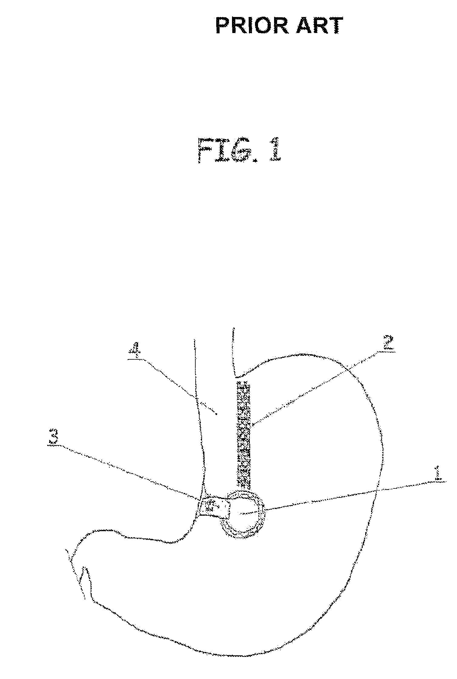 Gastric clamp for performing vertical band gastroplasty and a gastric bypass with lesser curvature