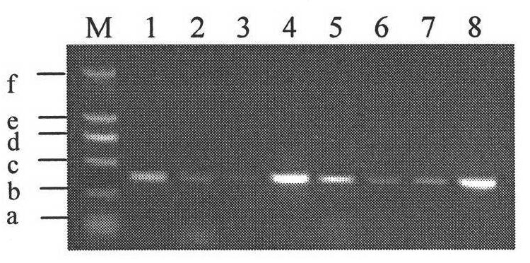 Molecular markers of paddy endosperm low amylose content gene Wx-mq