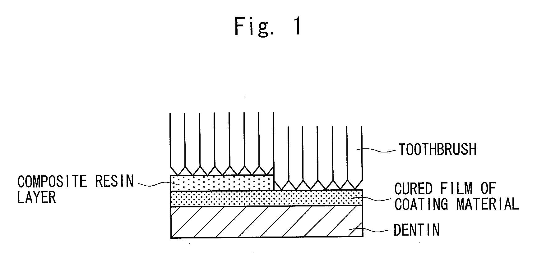 One-package type tooth surface coating material