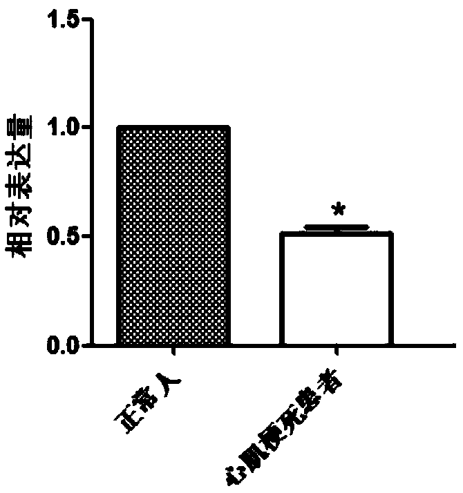 Application of KDSR gene to preparation of deagnostic tool for myocardial infarction