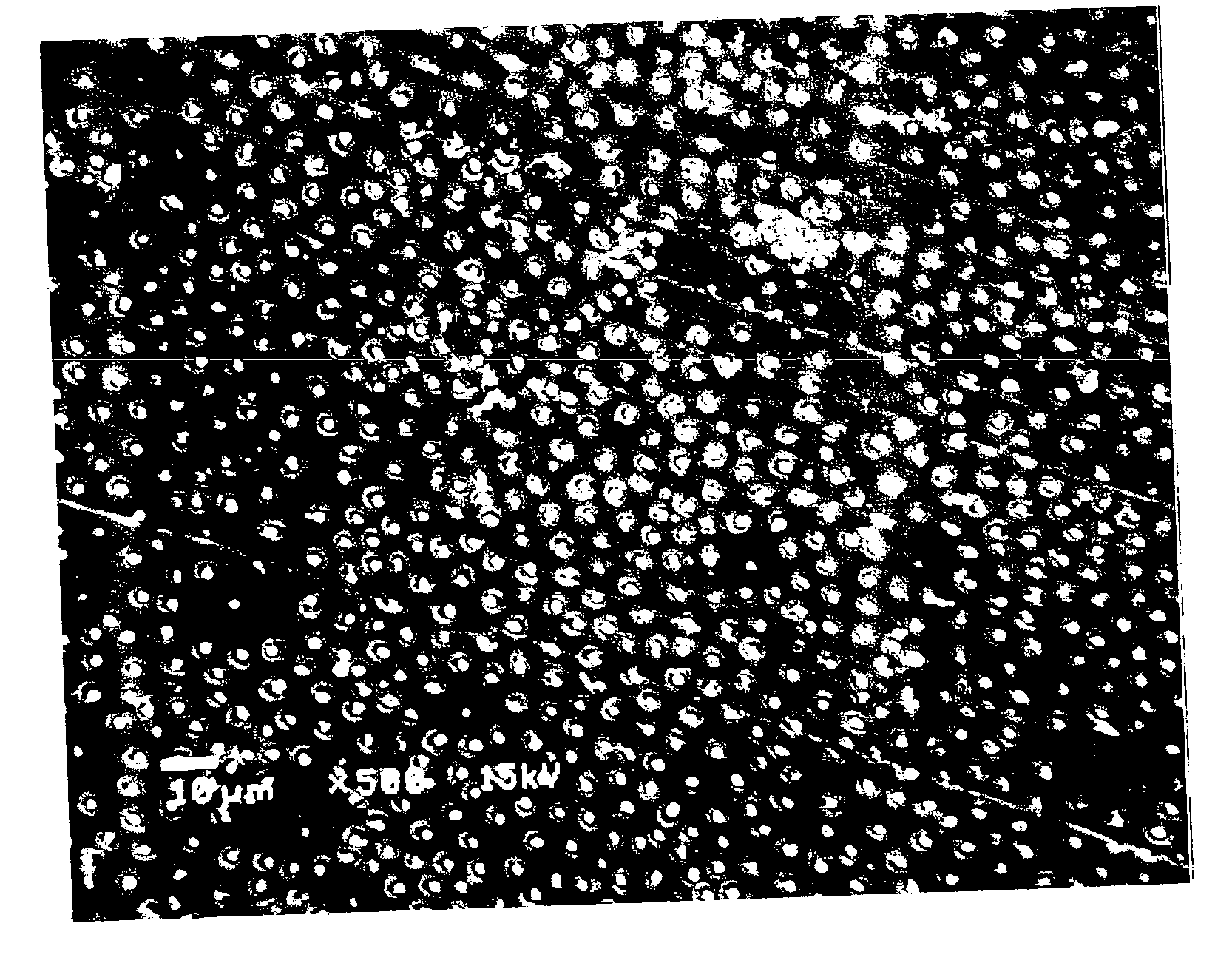 Method of etching and priming a tooth