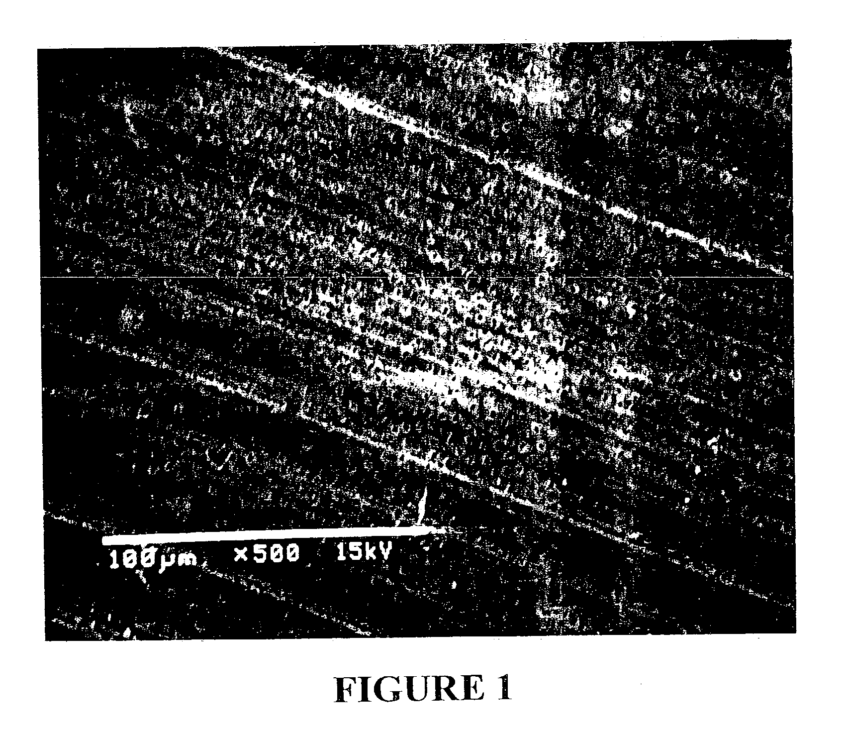 Method of etching and priming a tooth