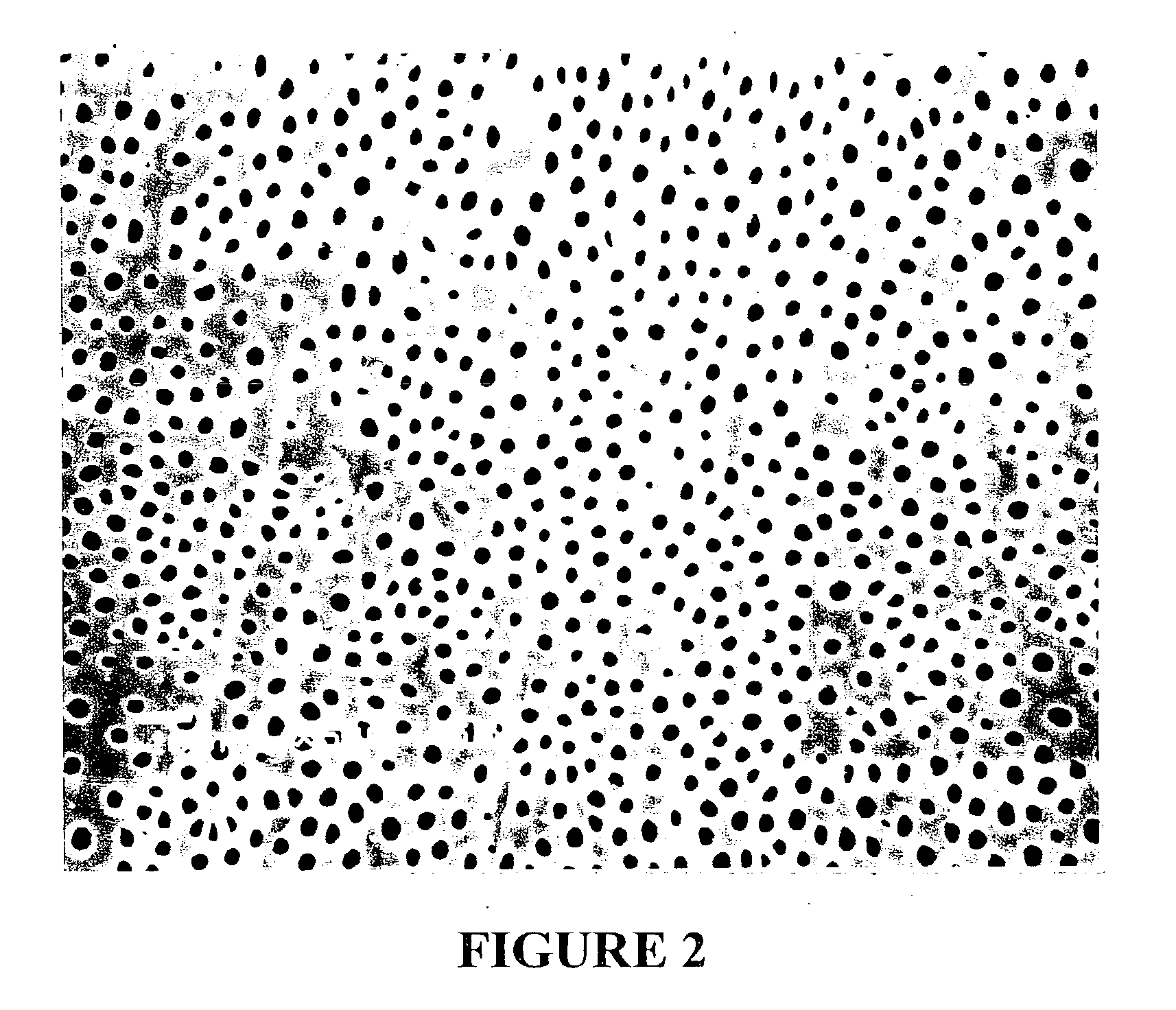 Method of etching and priming a tooth