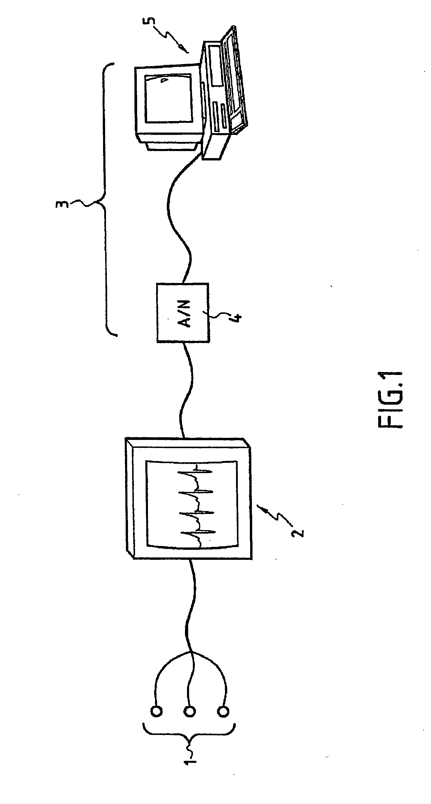 Method For Processing A Series Of Cardiac Rhythm Signals (Rr) And The Use Thereof For Analysing A Cardiac Rhythm Variability, In Particular For Assessing A Patient's Pain Or Stress