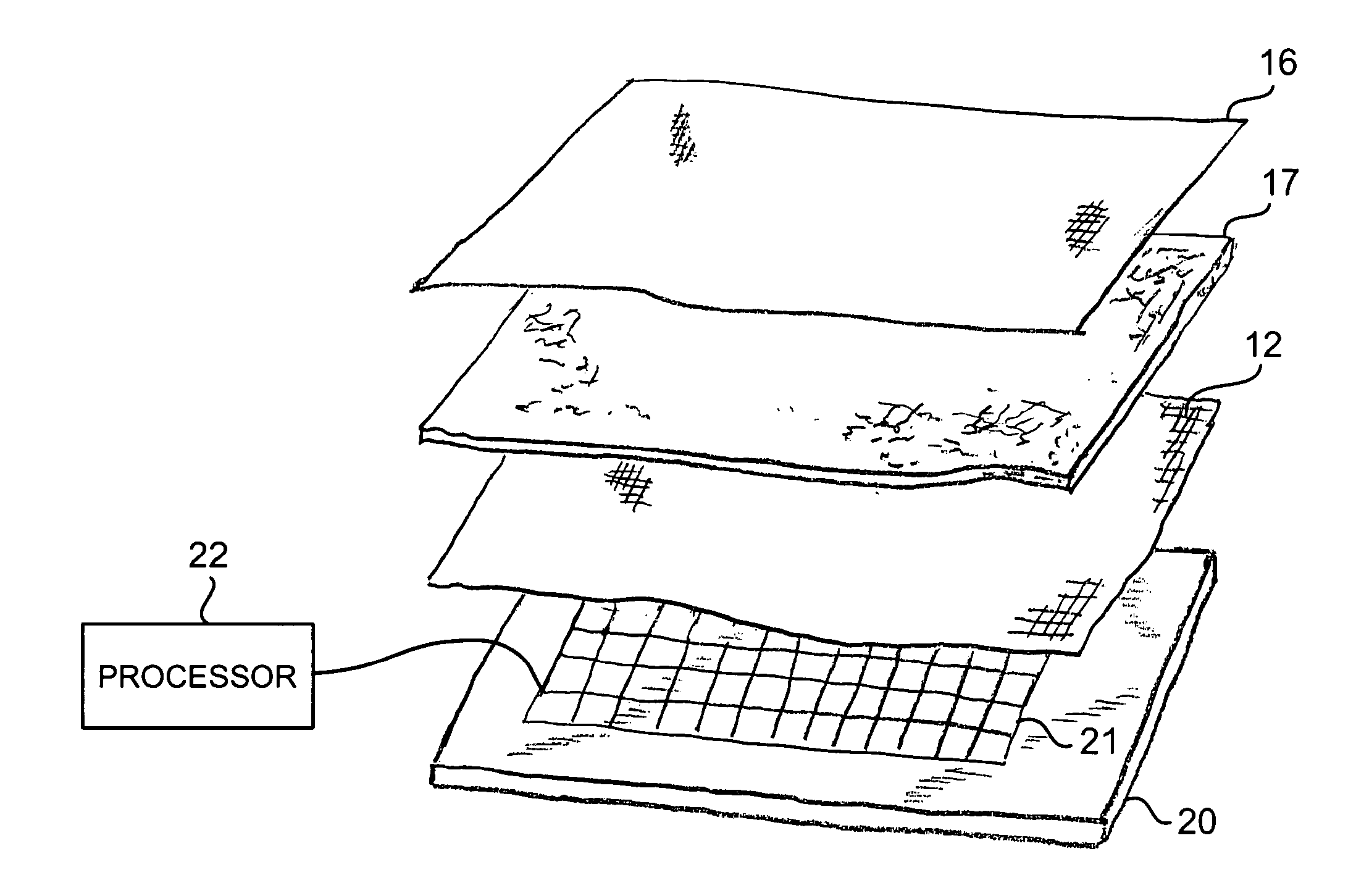 Devices for prevention of pressure ulcers