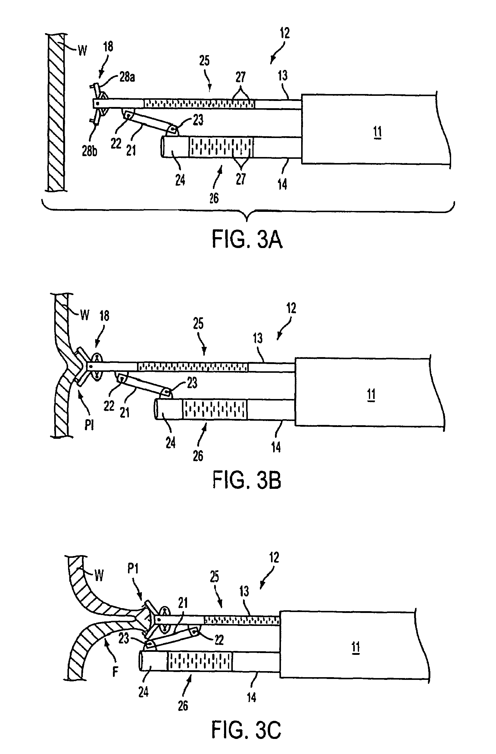 Apparatus and methods for forming and securing gastrointestinal tissue folds