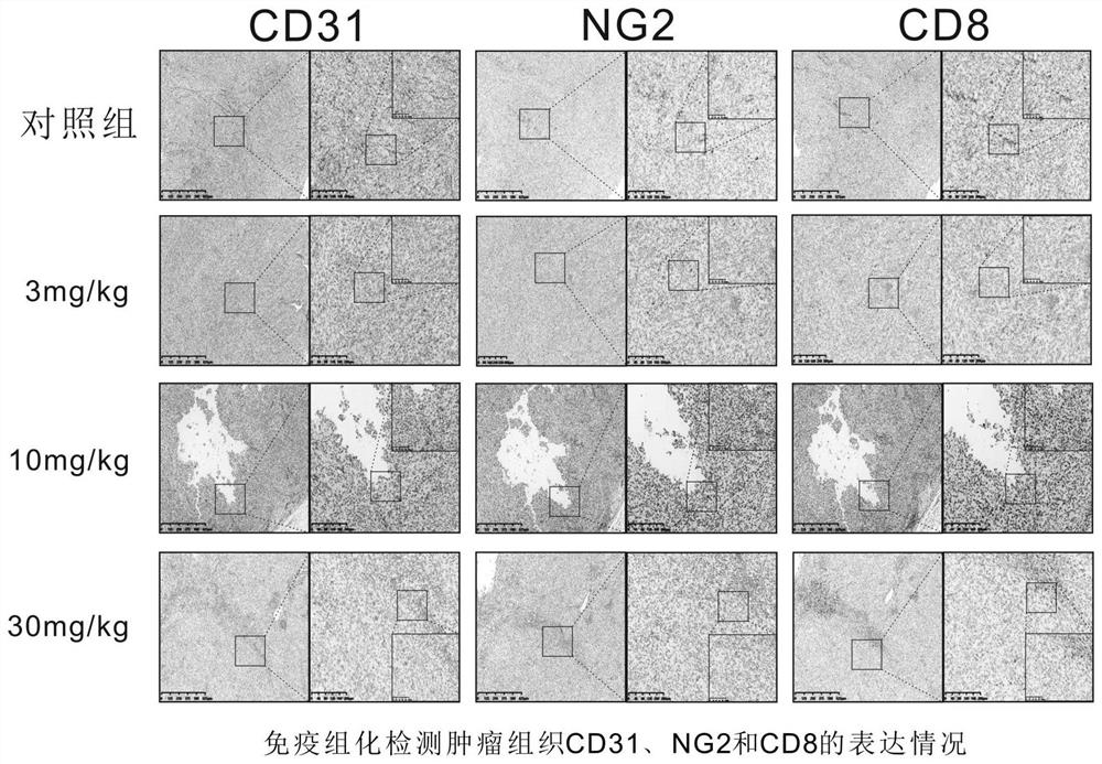 Application of combination of lenvatinib and PD-1 monoclonal antibody in preparation of anti-hepatoma drugs