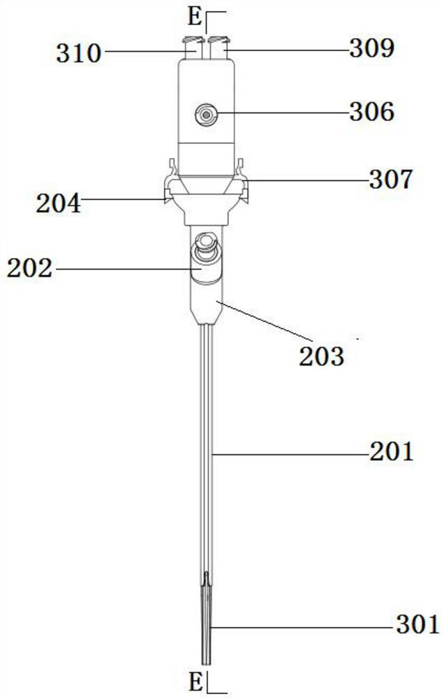 A combined structure of a sheath-feeding dilation tube and a ureteral sheath