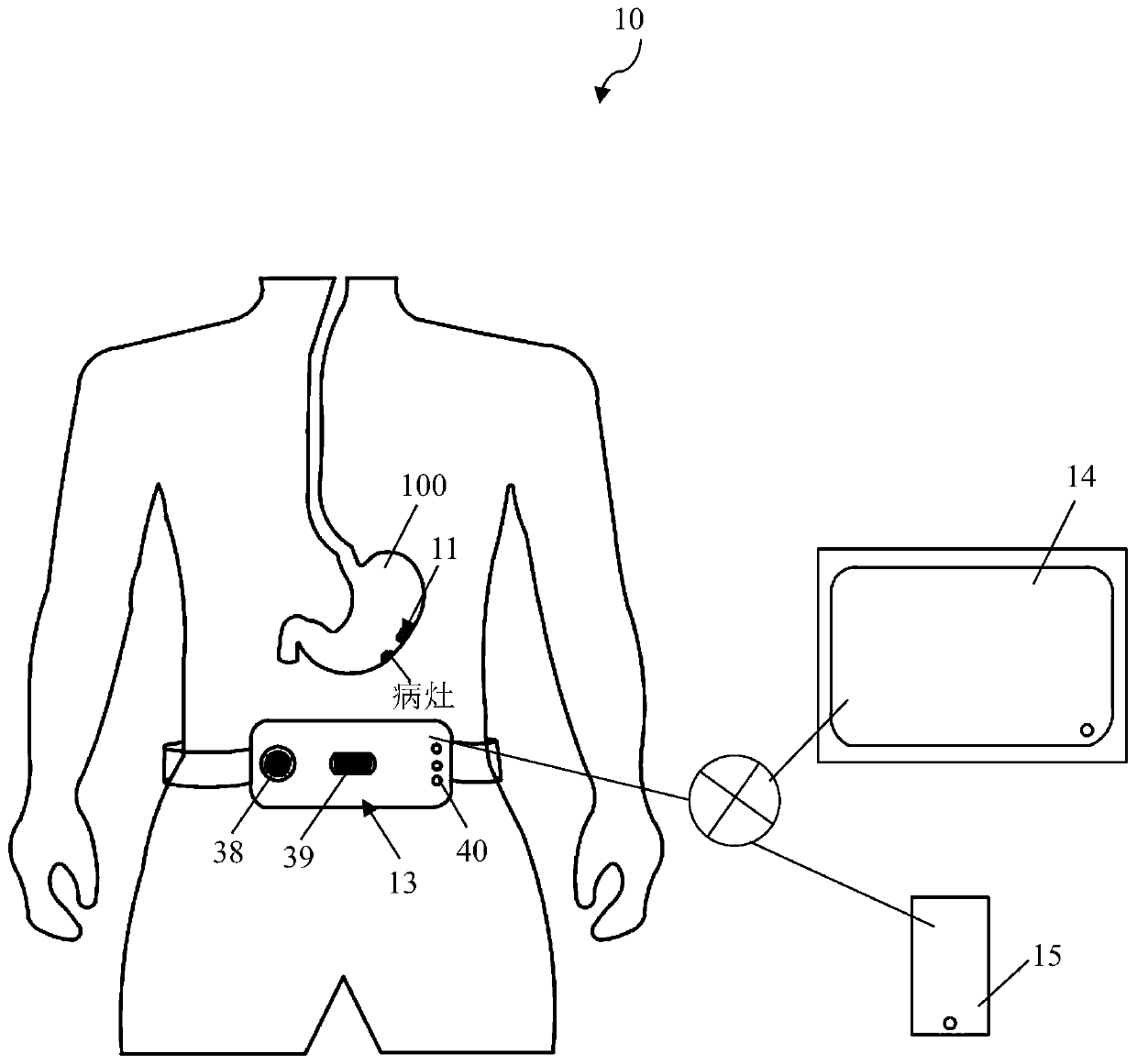 Fixable gastrorrhagia monitoring capsule endoscope and real-time gastrorrhagia monitoring system