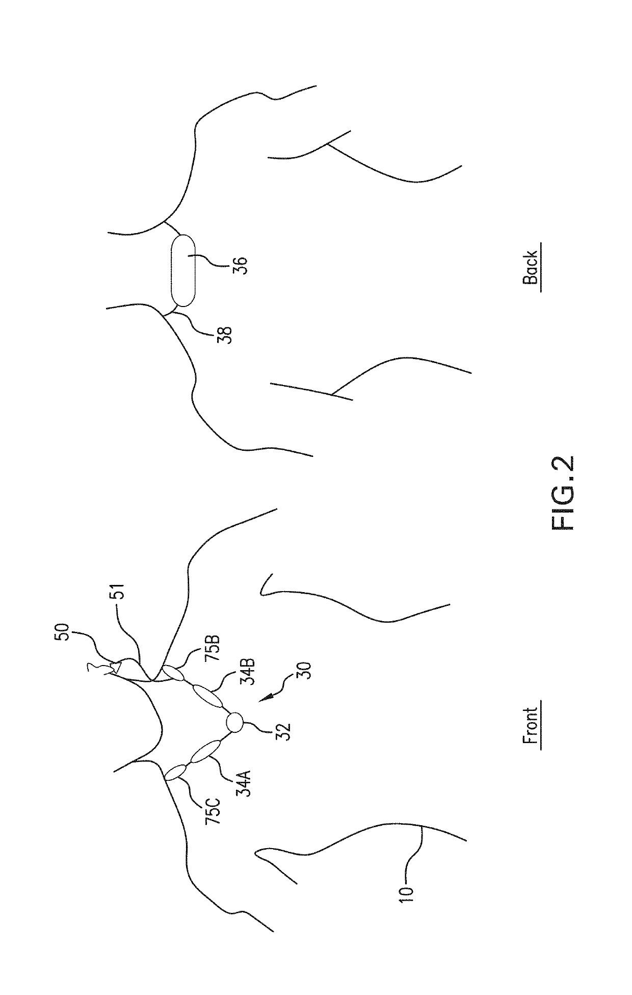 Necklace-shaped physiological monitor