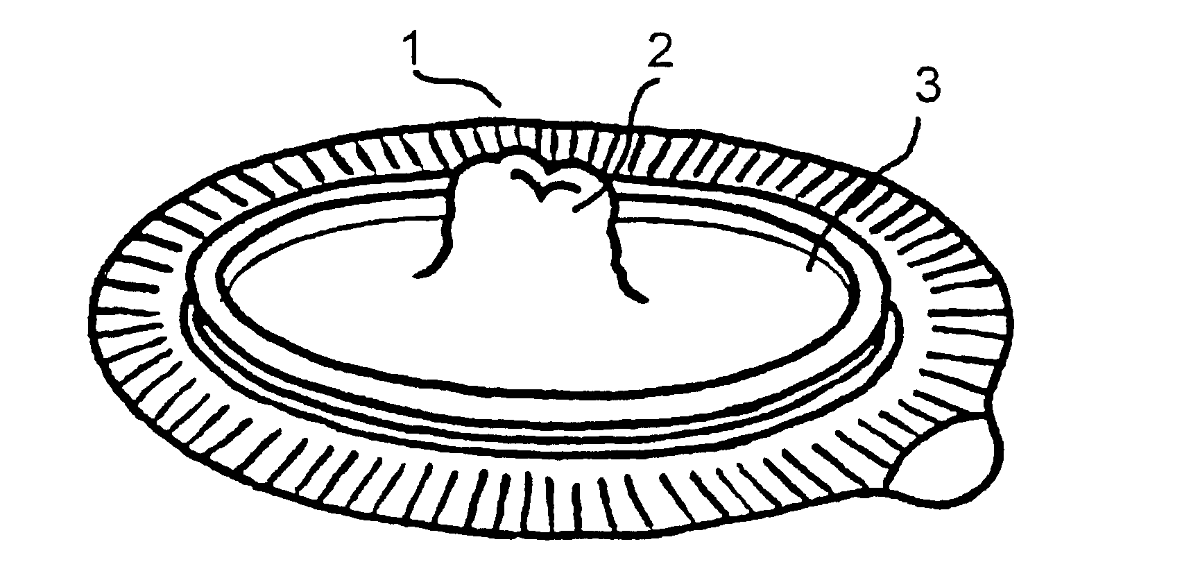 Ostomy siting device