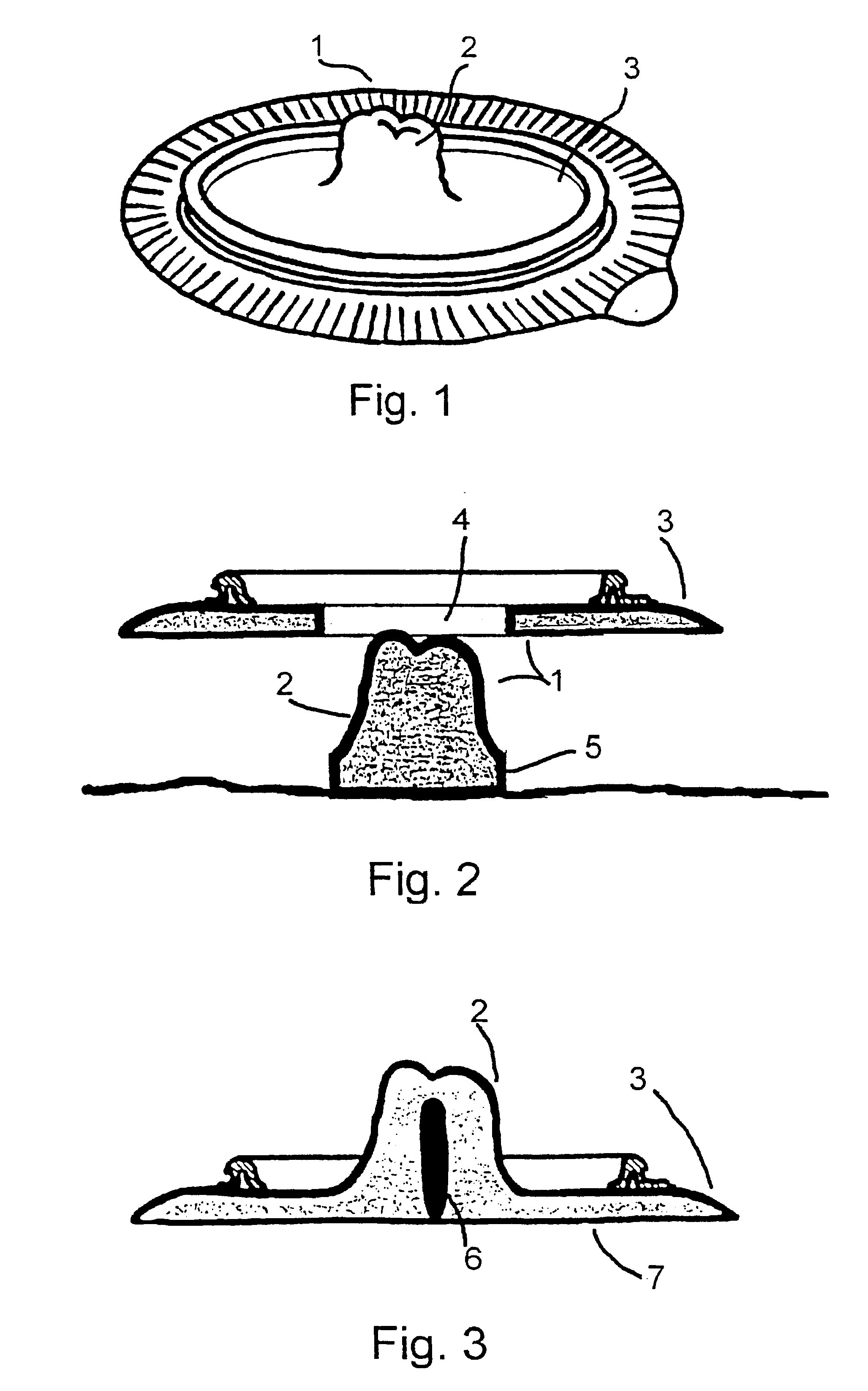 Ostomy siting device