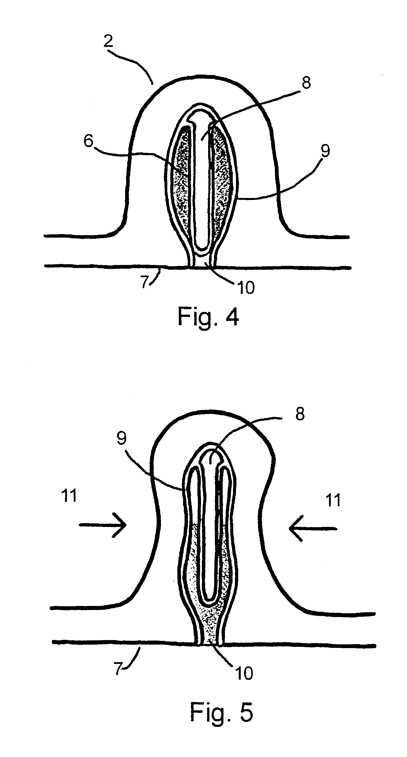 Ostomy siting device