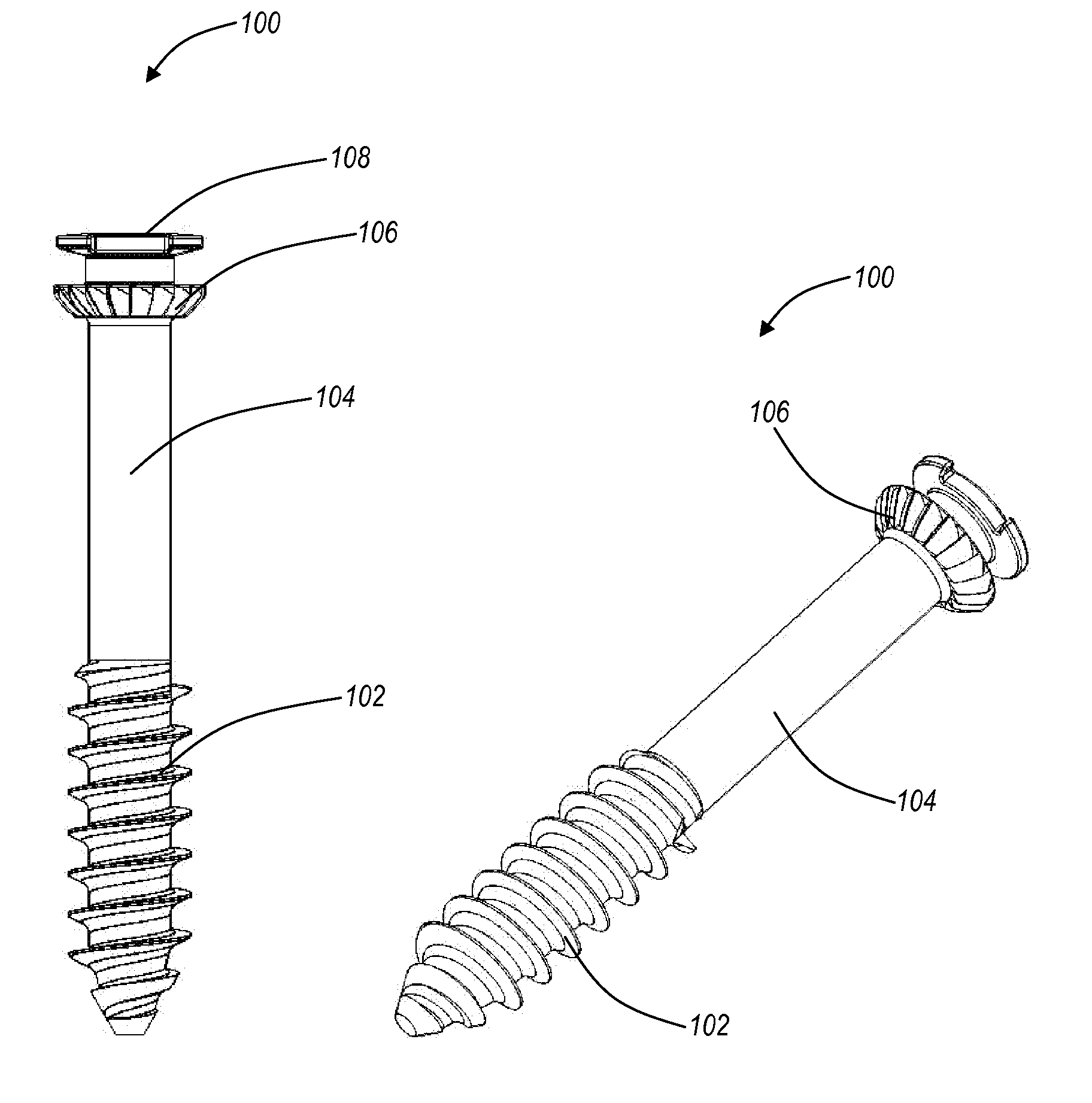 Interlocking bone screw and washer concepts