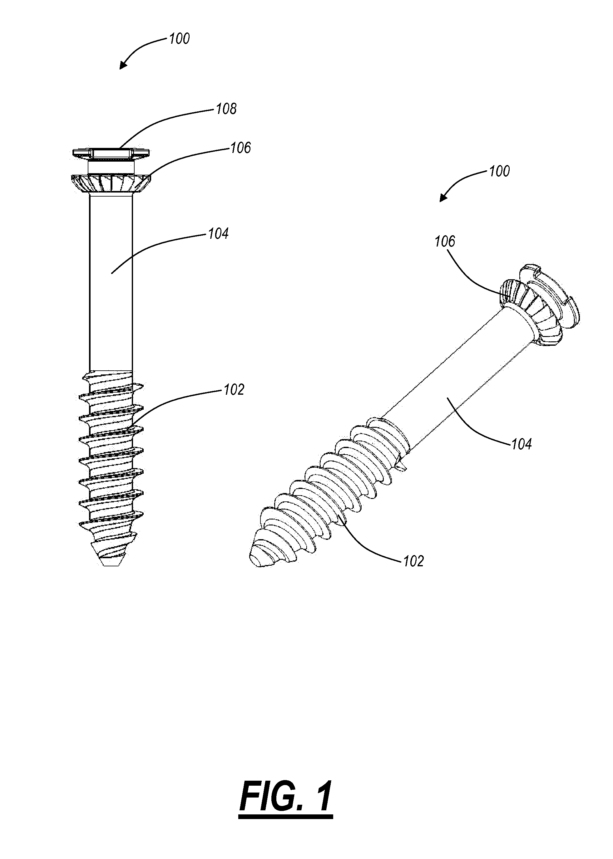 Interlocking bone screw and washer concepts