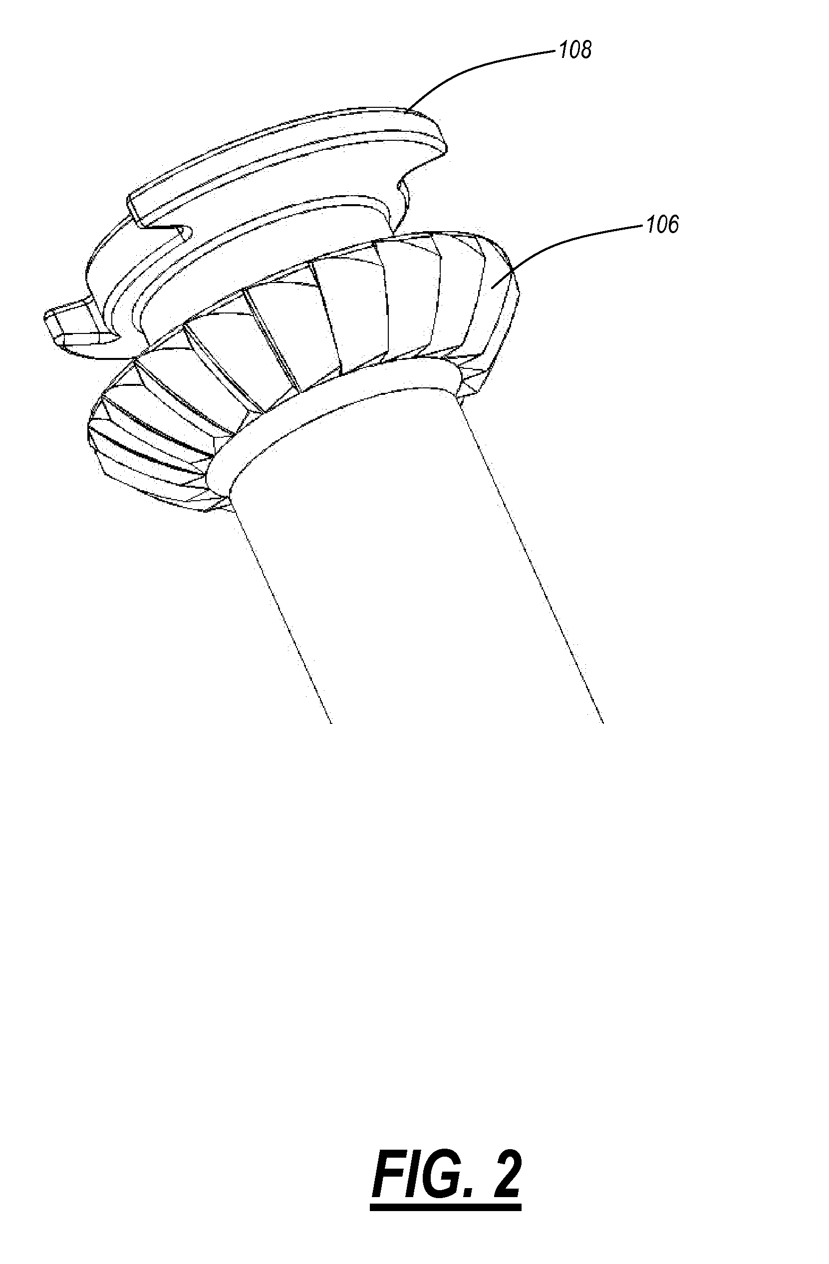 Interlocking bone screw and washer concepts